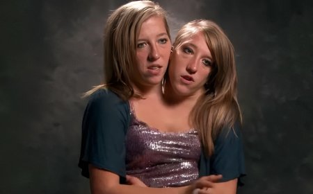 Are Abby and Brittany Hensel Married? Exploring the Reality of These Remarkable Twins